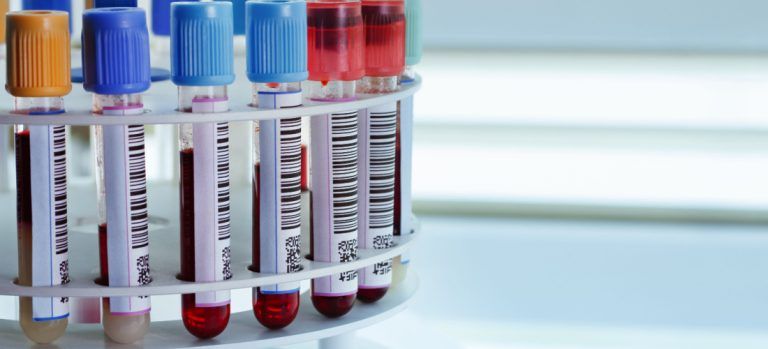 ¿Cuál es la mejor impresora para histología y tejidos?